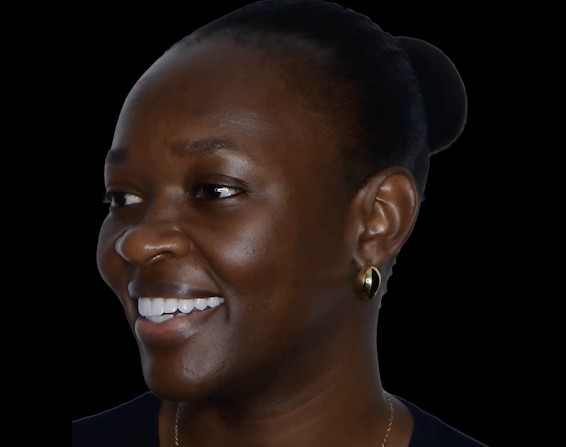 Dental implant patient smiling